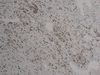 इम्यूनोलॉजी मोनोक्लोनल एंटीबॉडी के लिए एंटी-फ्लिम 1 माउस मैब