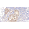 कैंसर रिसर्च IHC के लिए एंटी -67 खरगोश पाब यदि प्राथमिक एंटीबॉडी है