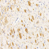 जीबी 11226 एंटी-माइलिन बेसिक प्रोटीन खरगोश पीएबी