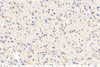 GB11181 एंटी-बॉस हाइड्रोक्साइलेस खरगोश पीएबी