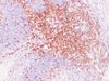 मानव immunohistochemistry immunofluorescence प्राथमिक एंटीबॉडी के लिए एंटी -सीडी 5 माउस एमएबी