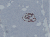मानव IHC के लिए एंटी-चिकनुसागोन माउस मैब अगर प्राथमिक एंटीबॉडी