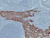 GB14053 विरोधी -Cytokeratin 14 CK14 माउस एमएबी